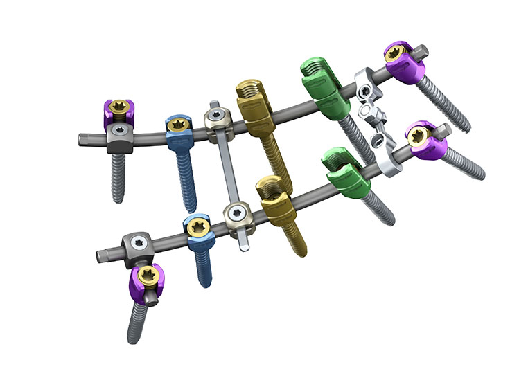 脊柱内固定系统