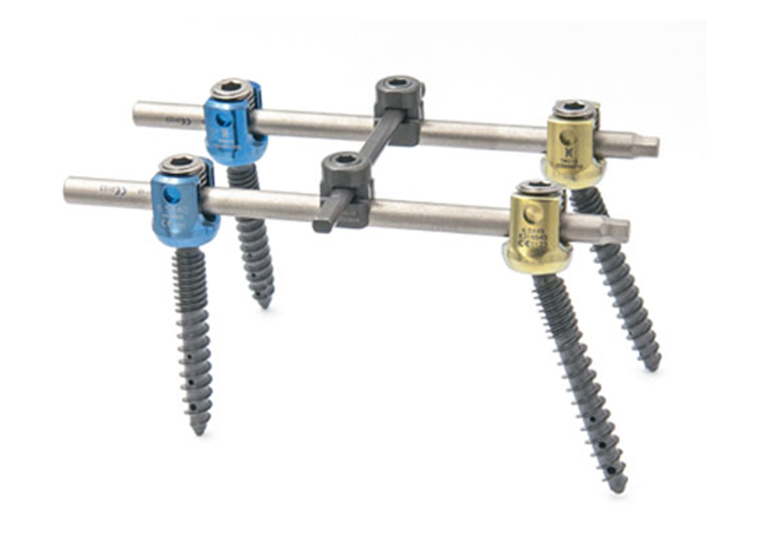 骨水泥椎弓根螺钉